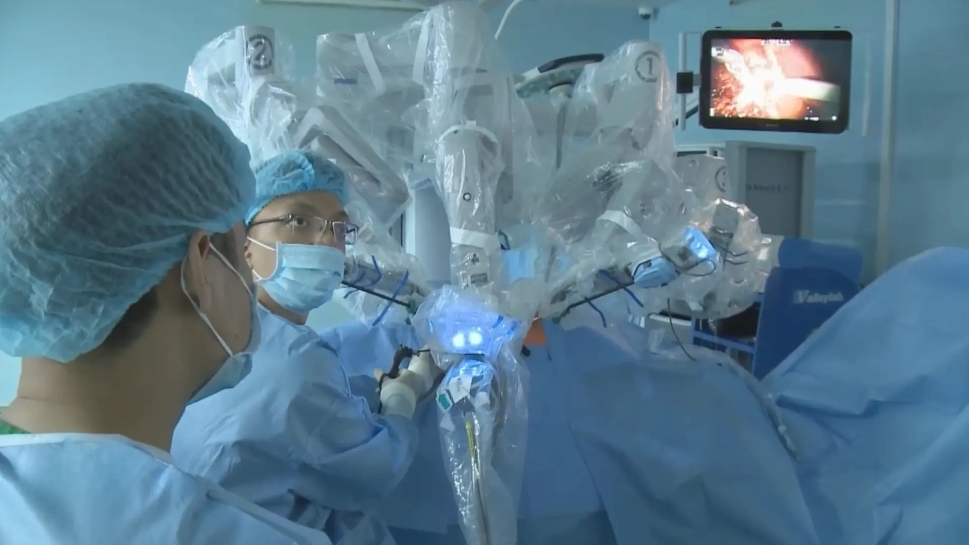 Phẫu thuật robot tăng hiệu quả điều trị tuyến tiền liệt